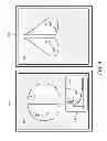 Fig. 06 - Displaying and navigating computer-aided detection results on a review workstation