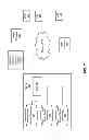 Fig. 07 - Asset conflict resolution for content on demand asset insertion