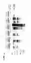 Fig. 07 - Vectors and Methods For Enhancing Recombinant Protein Expression in Plants