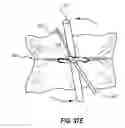 Fig. 29 - BALLISTIC PROTECTIVE CLOTHING