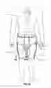 Fig. 30 - BALLISTIC PROTECTIVE CLOTHING
