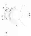 Fig. 03 - Protective headgear system