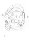 Fig. 09 - Protective headgear system