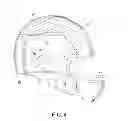 Fig. 05 - SYSTEMS AND METHODS FOR ATTENUATING ROTATIONAL ACCELERATION OF THE HEAD