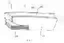Fig. 04 - Patient positioning device