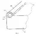 Fig. 08 - Patient positioning device