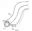 Fig. 11 - Patient positioning device