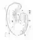 Fig. 13 - Nursing and infant support pillow with accessory unit