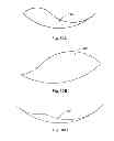 Fig. 13 - Back support device