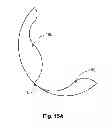 Fig. 20 - Back support device
