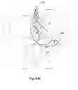 Fig. 22 - Back support device