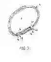 Fig. 04 - ADJUSTABLE LOOP ELEMENT