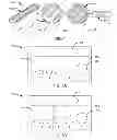 Fig. 03 - Ding detection system