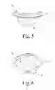 Fig. 05 - Cyclonic separator
