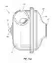Fig. 11 - PAP device with core and vibration isolation system to support the core