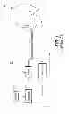 Fig. 02 - Method and apparatus for treating apnea/hypopnea
