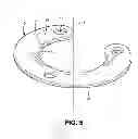 Fig. 04 - Iris shield
