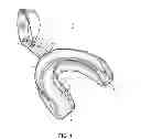 Fig. 02 - Flavored Boil and Bite Mouthguard