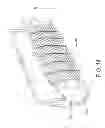 Fig. 15 - Method of fabrication of a weave of material strips within a metal mesh