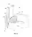 Fig. 15 - High power laser decomissioning of multistring and damaged wells