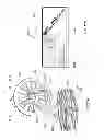 Fig. 17 - High power laser decomissioning of multistring and damaged wells