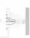 Fig. 03 - Temporary Cap for a Blownout Subsea Wellhead