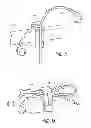 Fig. 03 - Cordage restraint and management system