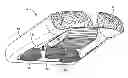 Fig. 01 - Hull robot drive system