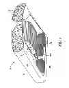 Fig. 02 - Hull robot drive system
