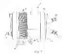 Fig. 08 - Filter member and oxygenator using same