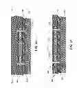 Fig. 22 - Method of fabricating an implantable medical device that includes one or more thin film polymer support layers