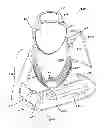 Fig. 05 - INDUCTION HEATING DEVICE FOR HEATING A LIQUID