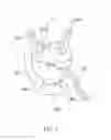 Fig. 02 - Spraying apparatus having water and air intakes
