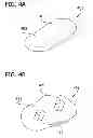Fig. 05 - OSTEOCHONDRAL IMPLANTS, ARTHROPLASTY METHODS, DEVICES, AND SYSTEMS