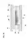 Fig. 10 - OSTEOCHONDRAL IMPLANTS, ARTHROPLASTY METHODS, DEVICES, AND SYSTEMS