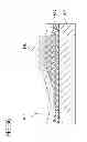 Fig. 12 - OSTEOCHONDRAL IMPLANTS, ARTHROPLASTY METHODS, DEVICES, AND SYSTEMS