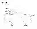 Fig. 13 - OSTEOCHONDRAL IMPLANTS, ARTHROPLASTY METHODS, DEVICES, AND SYSTEMS