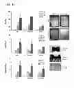 Fig. 26 - OSTEOCHONDRAL IMPLANTS, ARTHROPLASTY METHODS, DEVICES, AND SYSTEMS