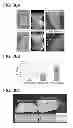 Fig. 37 - OSTEOCHONDRAL IMPLANTS, ARTHROPLASTY METHODS, DEVICES, AND SYSTEMS