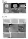 Fig. 44 - OSTEOCHONDRAL IMPLANTS, ARTHROPLASTY METHODS, DEVICES, AND SYSTEMS