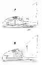 Fig. 01 - Apparatus for altering the ramp angle of a ski binding and method for optimizing the (fore-aft) balance of a skier