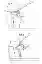 Fig. 07 - SMALL OVERLAP FRONTAL IMPACT COUNTER-MEASURE