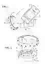 Fig. 02 - POWER BRACELET