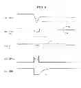 Fig. 09 - Gate driving device