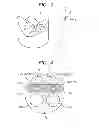 Fig. 03 - ENDOSCOPIC SYSTEM