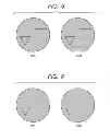 Fig. 04 - ENDOSCOPIC SYSTEM