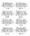 Fig. 04 - BGA structure using CTF balls in high stress regions