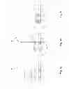 Fig. 04 - Apparatus and method for sterilization and organization of a tamper resistant lock and receptacle