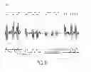 Fig. 06 - Adaptive detector threshold compensation in binary frame based communication systems