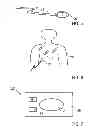 Fig. 03 - Radiation detector and measurement device for detecting X-ray radiation
